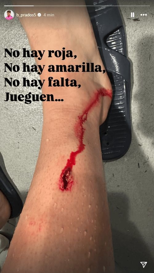  Herida de Beñat Prados en su pierna tras la entrada de Lindelof.