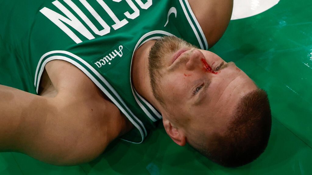  Kristaps Porzingis con una herida en la nariz (Cordon Press)