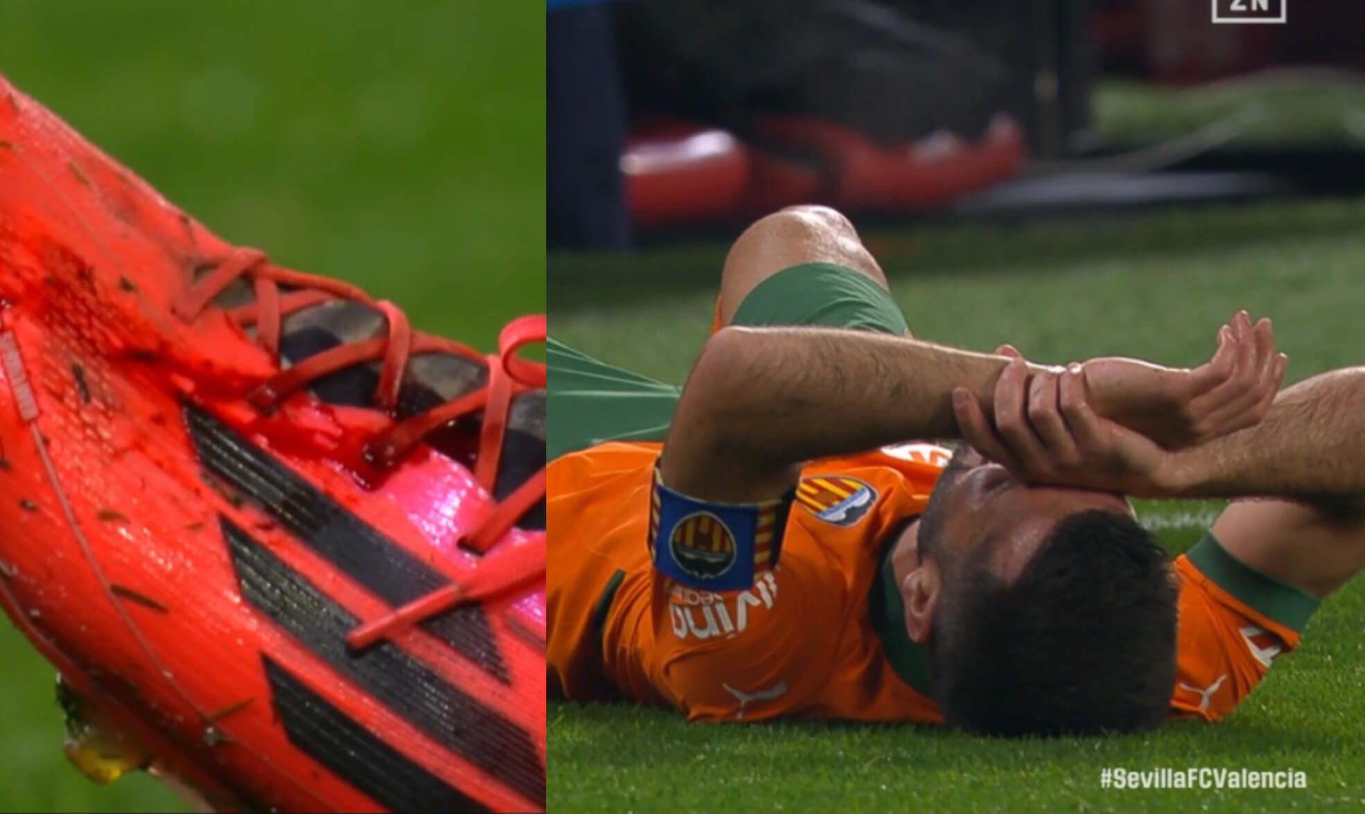 José Luis Gayà paga con sangre su regreso a los terrenos de juego