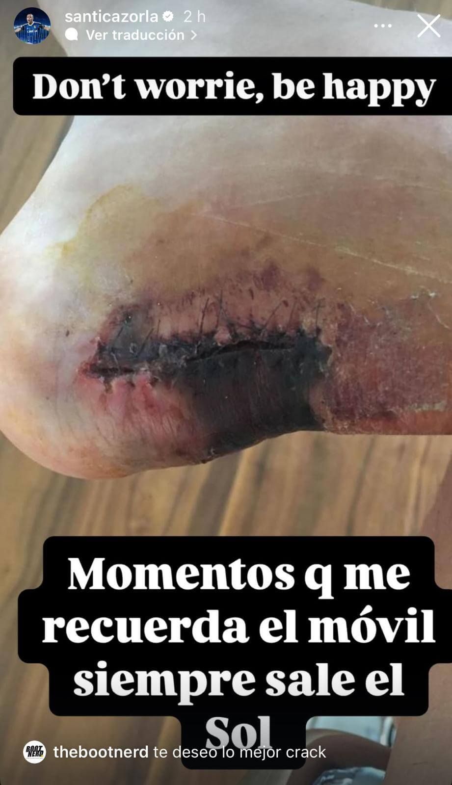  Santi Cazorla comparte el estado de su talón en su perfil oficial de Instagram.