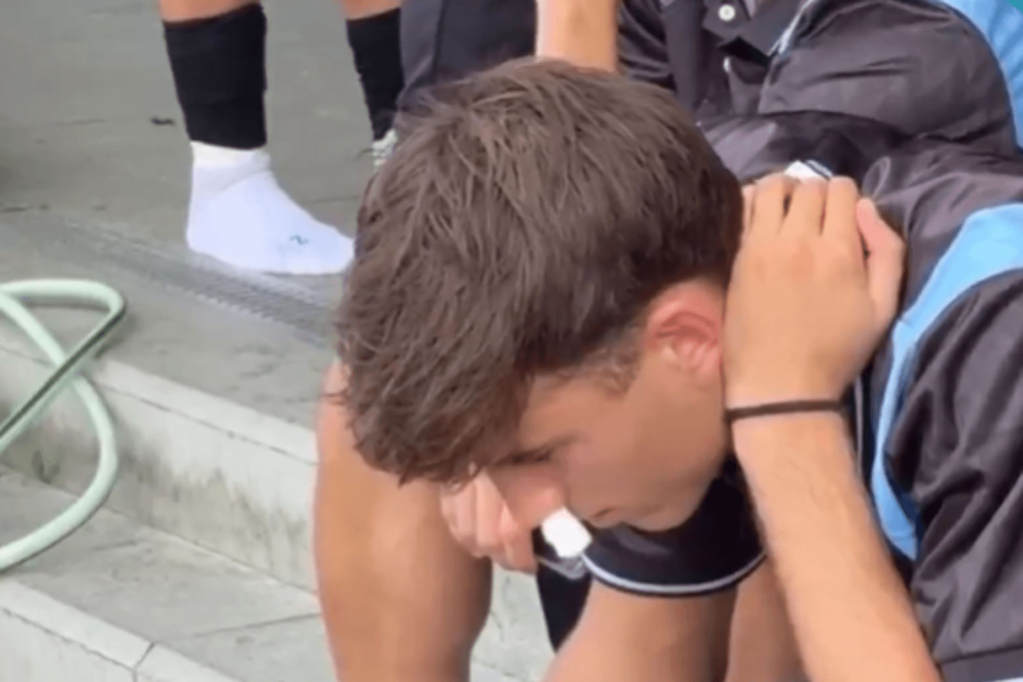  Javi Rodríguez con la nariz rota.