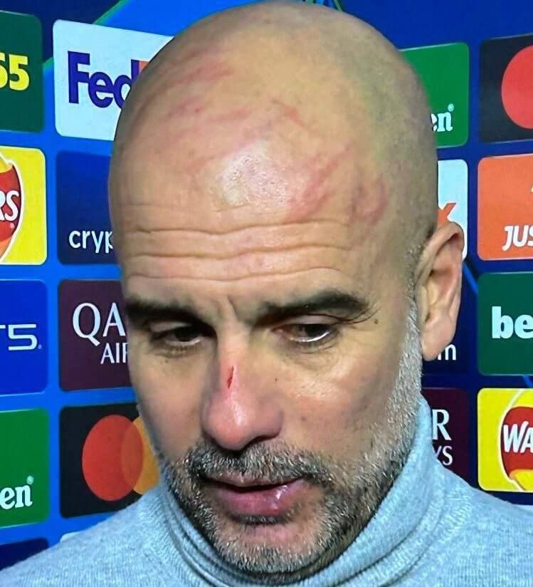 Así acabó Pep Guardiola tras el Manchester City-Feyenoord.