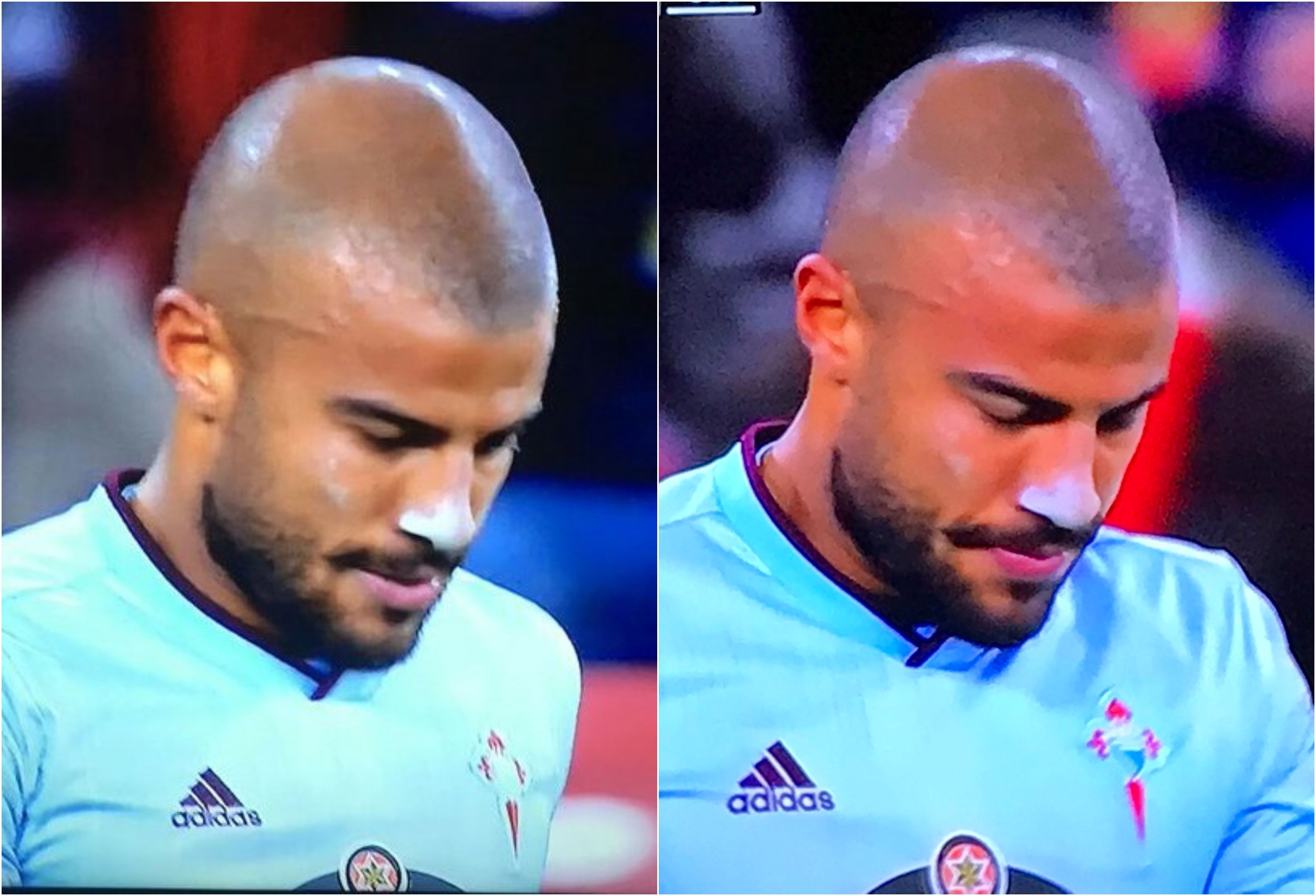 Rafinha, con la nariz 'empolvada' en el Athletic-Celta.