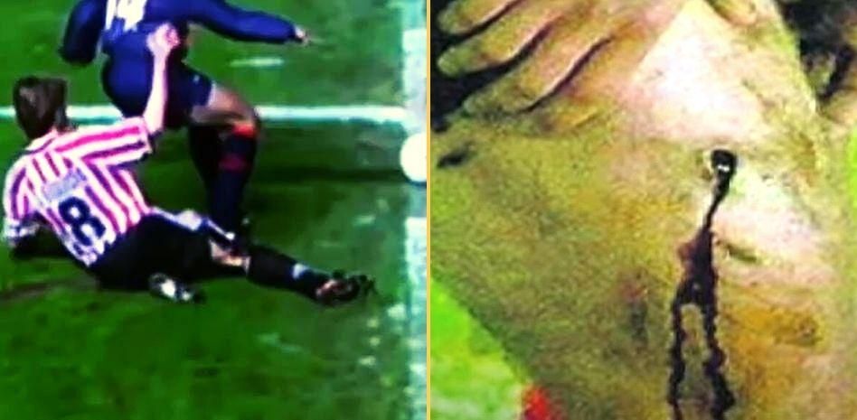 El pisotón de Simeone a Julen Guerrero.