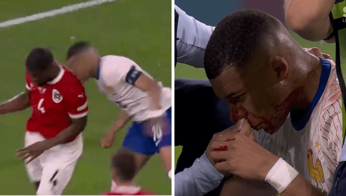 El duro choque de Mbappé con Danso.