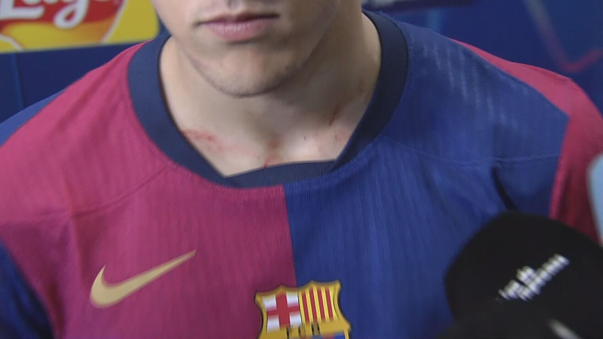  Las heridas de ‘guerra’ de Pau Cubarsí