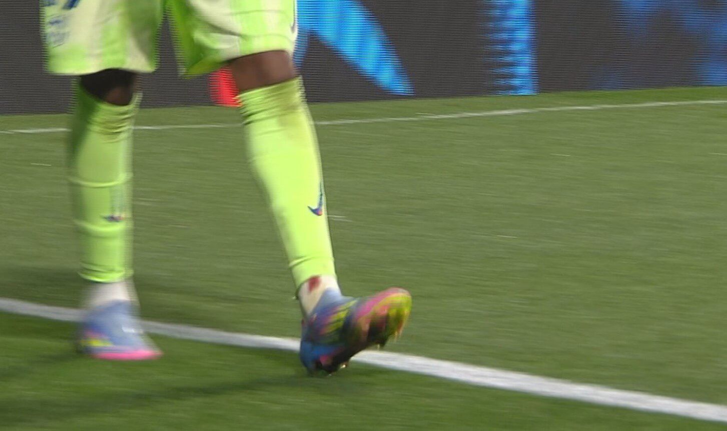  Lamine Yamal, con el tobillo sangrando en el Atlético-Barcelona.