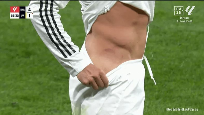 La herida de Lucas Vázquez tras la falta de benito.