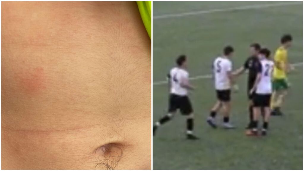 Fotografía y momento del supuesto pellizco al jugador de fútbol base.