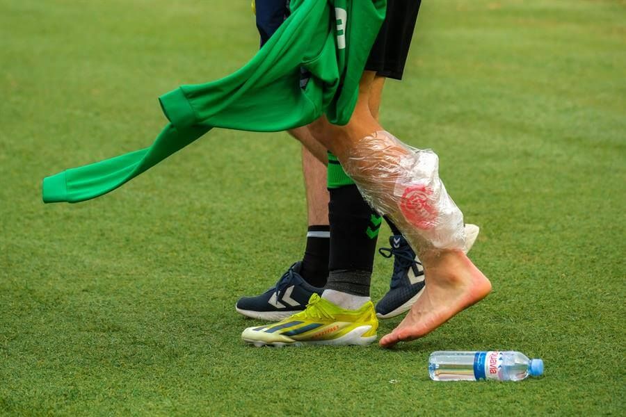  Imagen de la pierna de Isco tras lesionarse frente a Las Palmas.