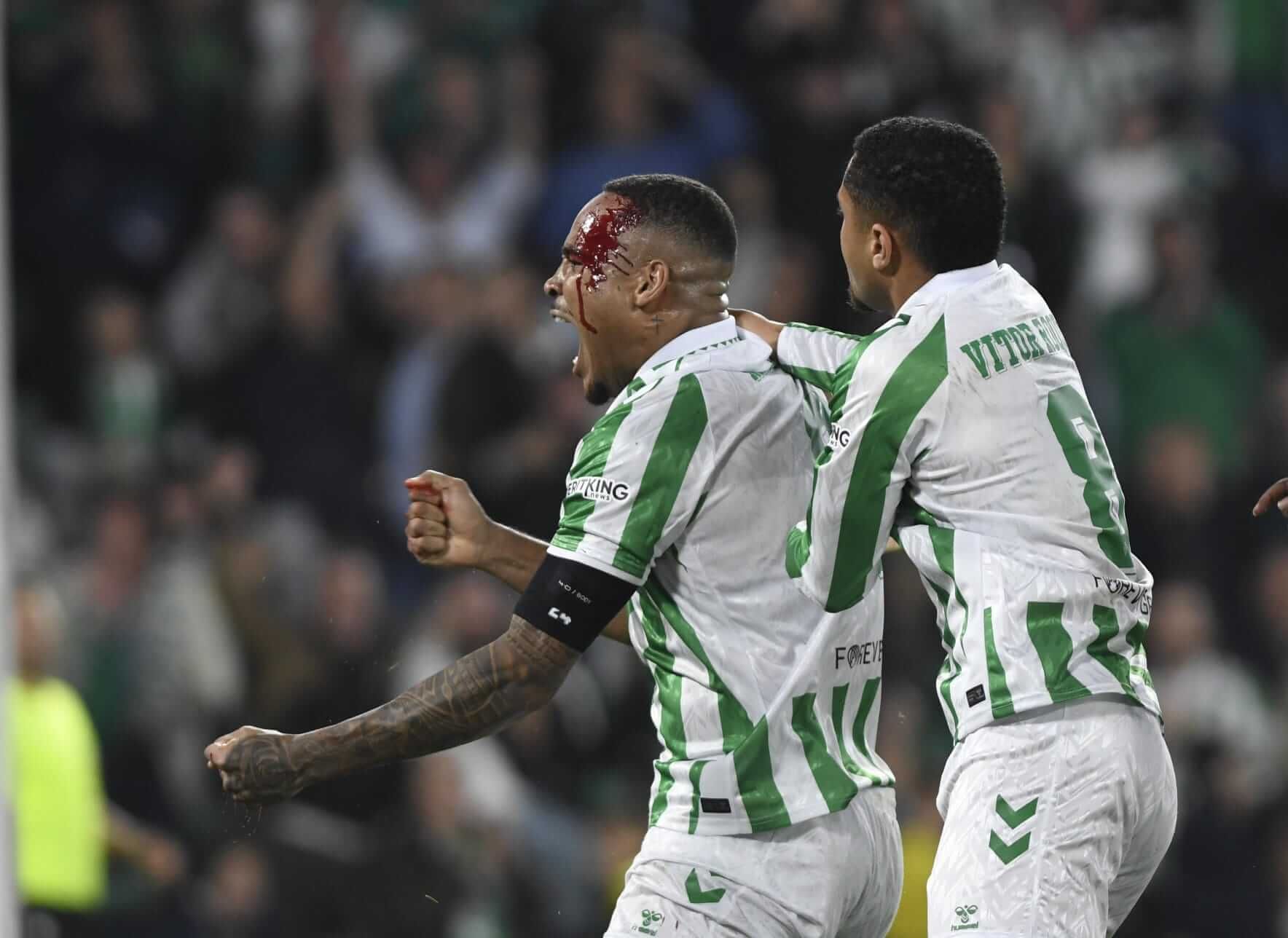  La impactante brecha de Natan tras anotar ante el Celje.