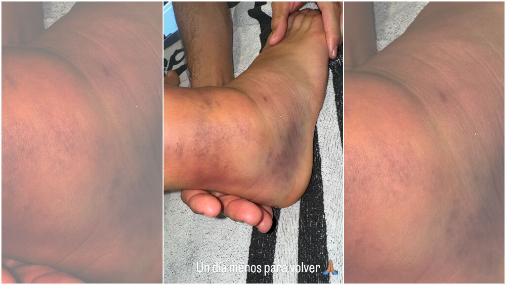  El pie de ceballos (danifuli10)