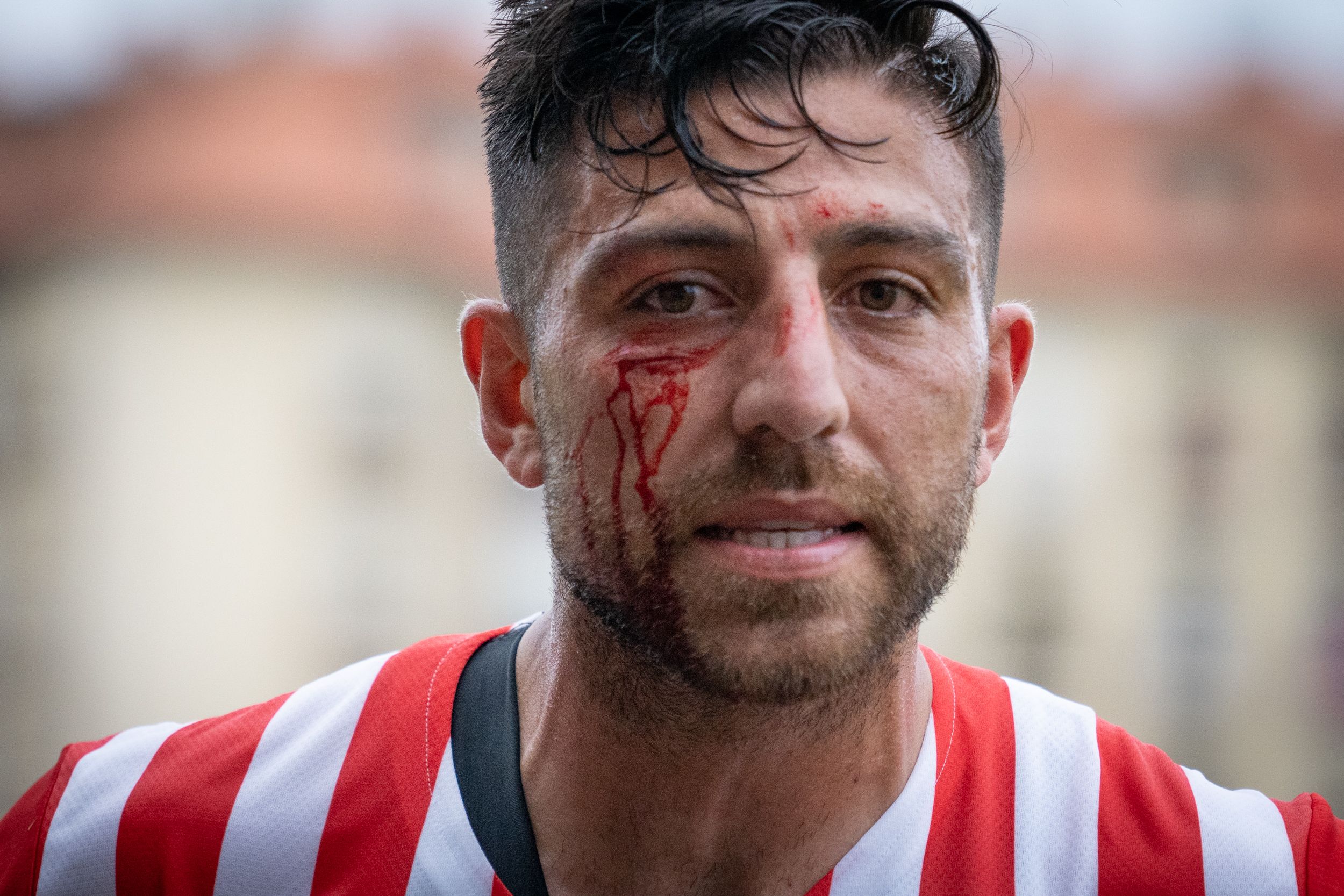 Herida de Zarfino en un amistoso. Foto: Real Sporting.