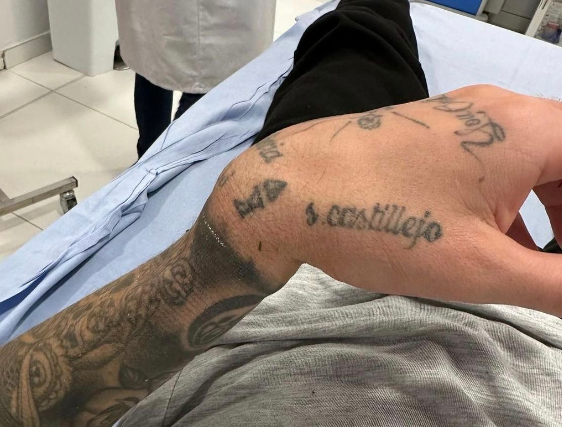 Samu Castillejo tiene rota la muñeca a cinco días de la Supercopa