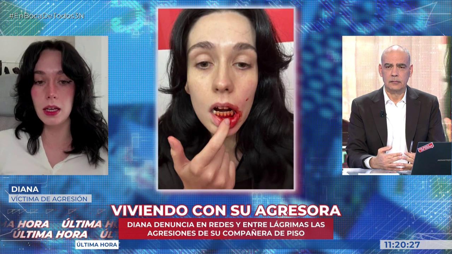 La herida en la boca de Diana tras la agresión