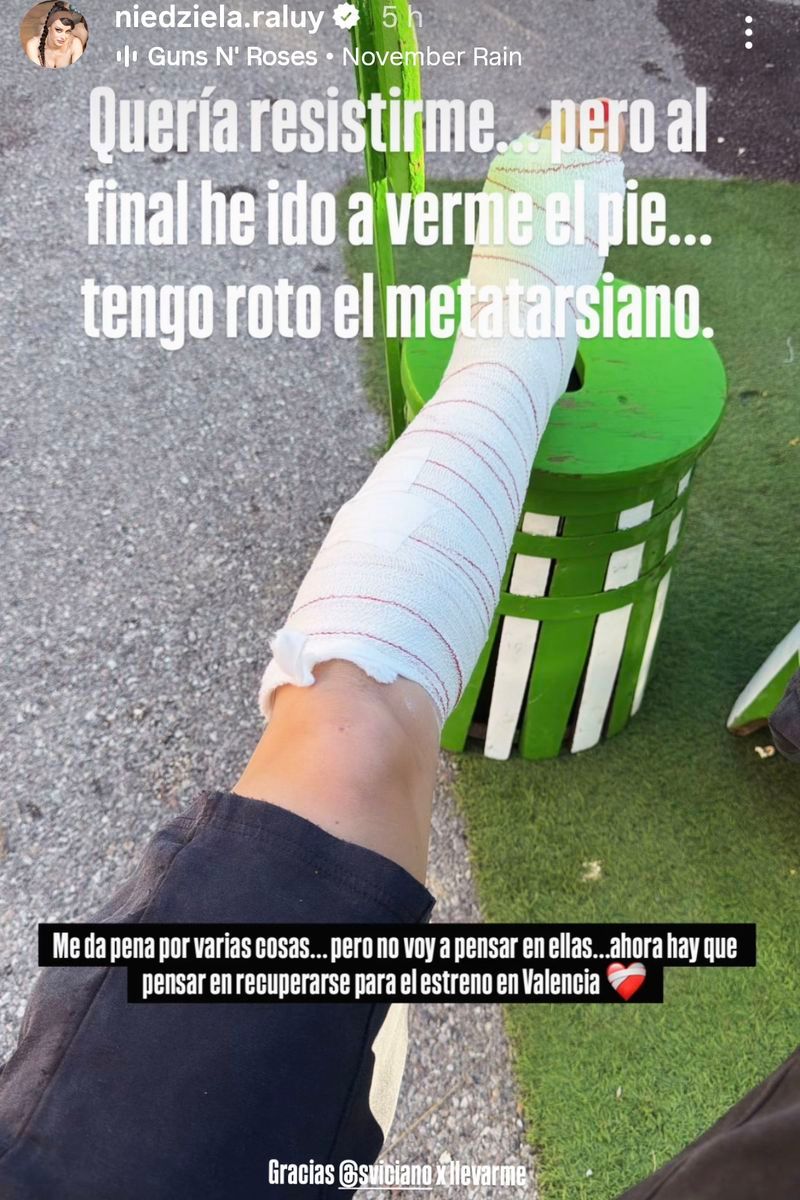 Niedziela Raluy, preocupada tras lesionarse en plena gira del circo