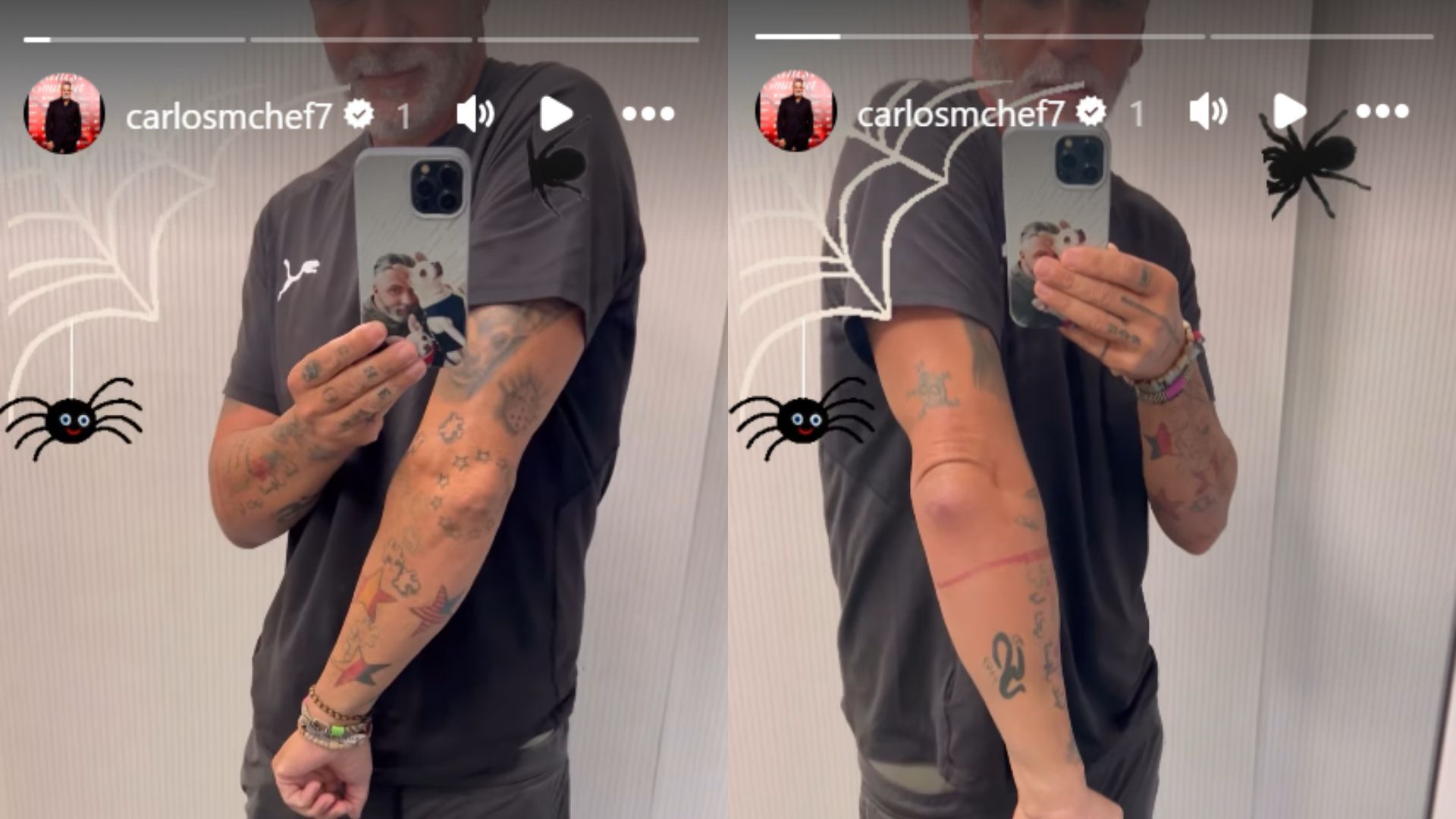 Carlos Alba. A la derecha, la inflamación de su brazo