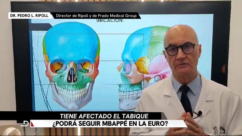 El doctor Ripoll sobre la fractura de nariz de Kylian Mbappé