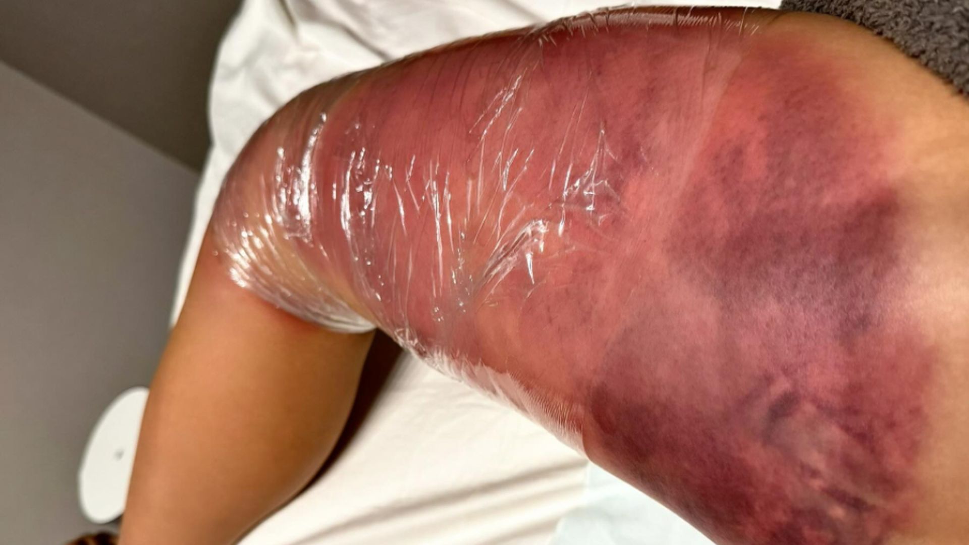 asi_quedo_la_pierna_de_un_luchador_de_kickboxing_instagram_de__k1takeru__001.jpg asi_quedo_la_pierna_de_un_luchador_de_kickboxing_instagram_de__k1takeru__001.jpg