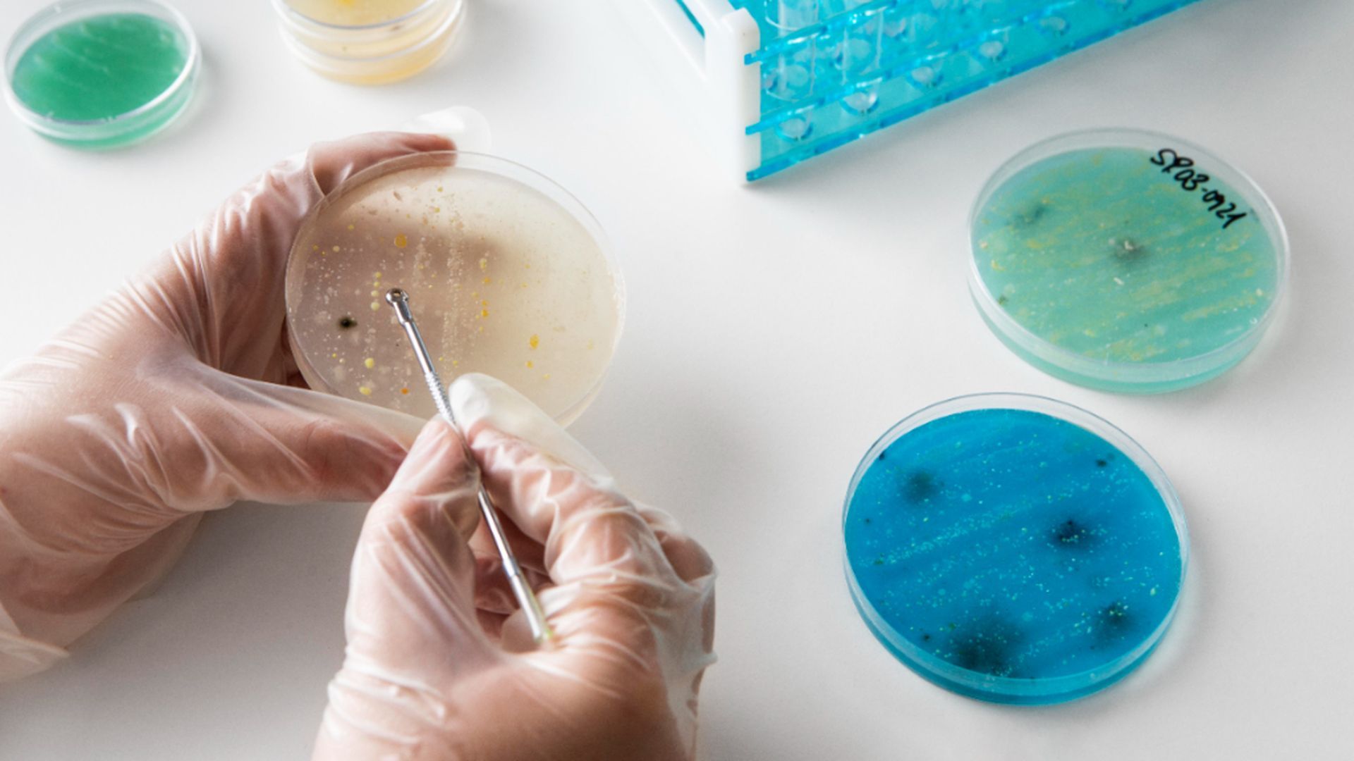 asocian_los_metales_pesados_con_las_patologias_cronicas.jpg asocian_los_metales_pesados_con_las_patologias_cronicas.jpg