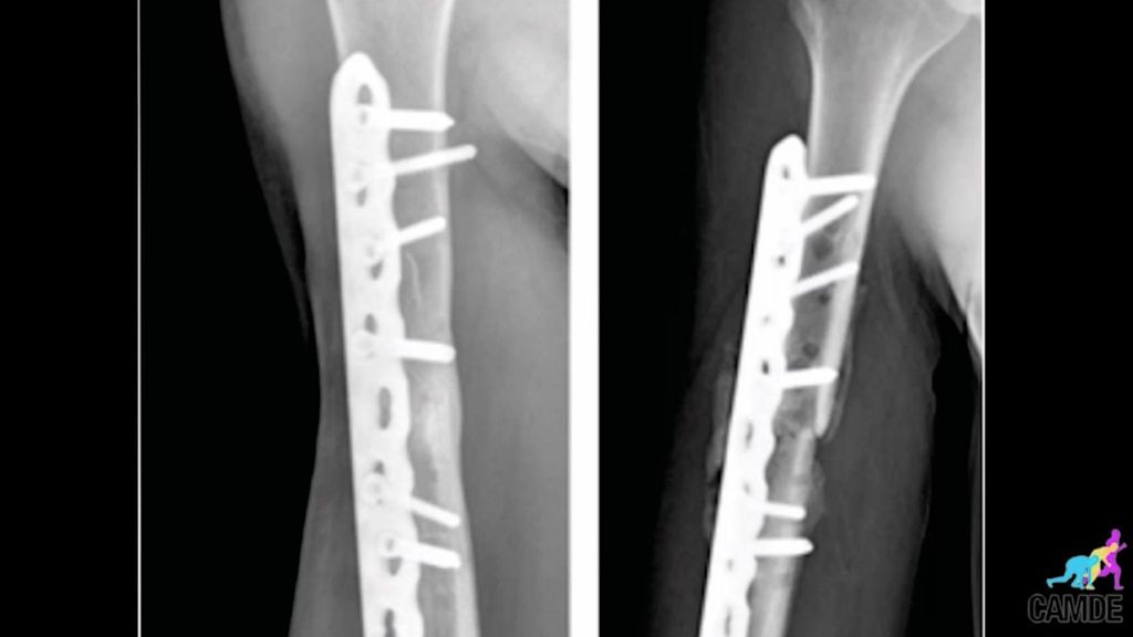 La fractura de húmero de Marc Márquez