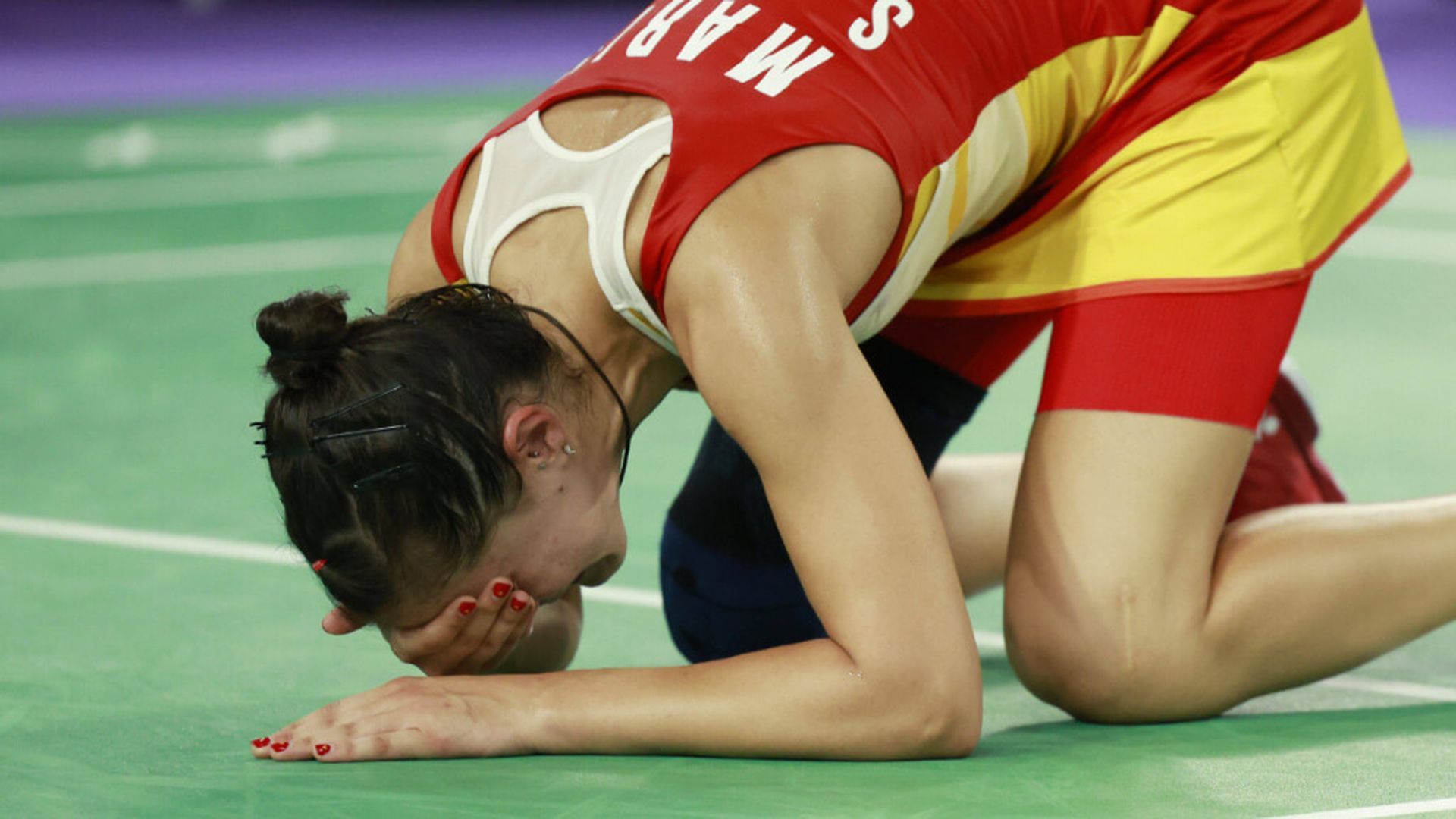 carolina_lesionjpg_001.jpg carolina_lesionjpg_001.jpg