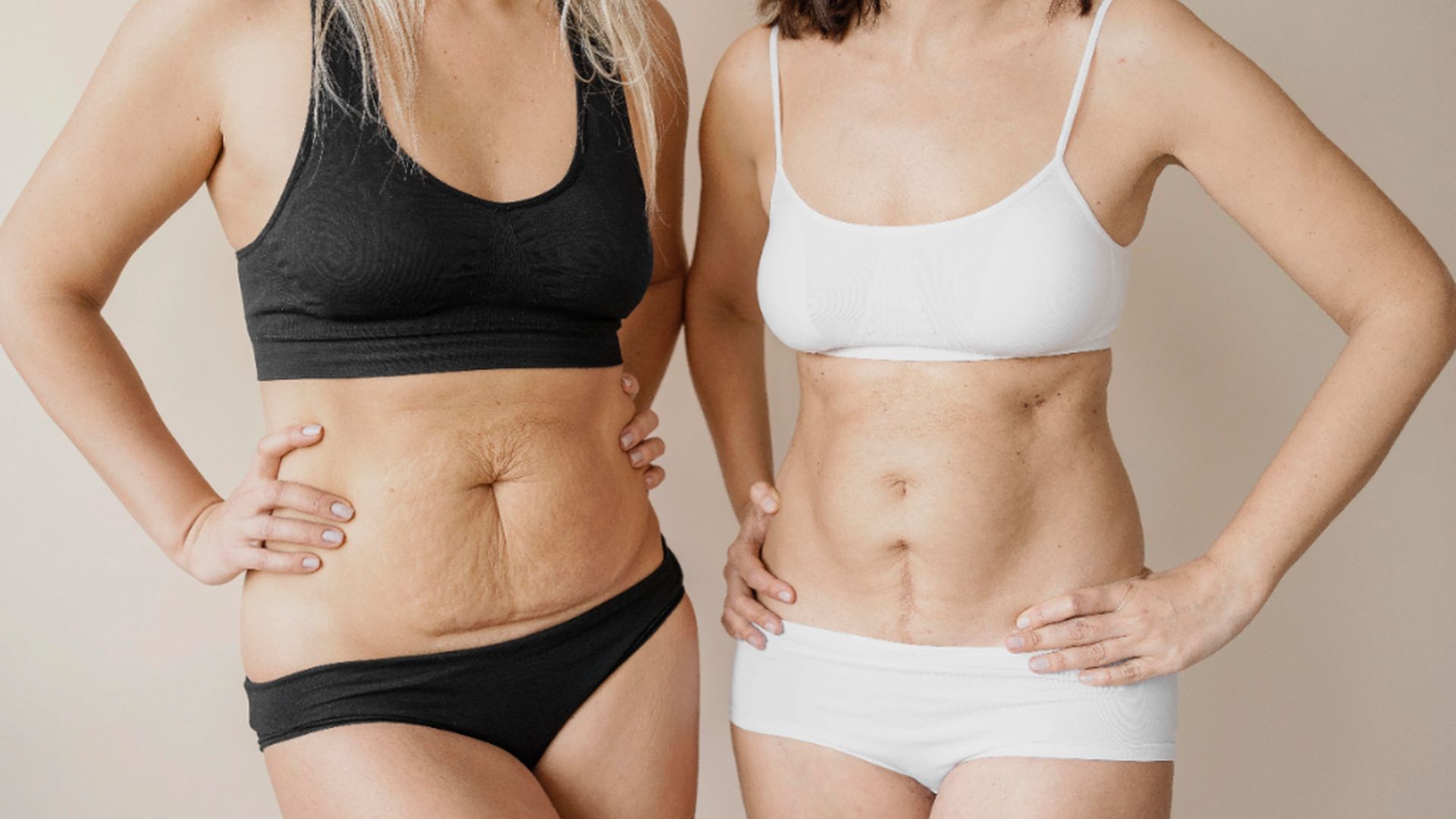 dos_tercios_de_las_mujeres_presentan_diastasis_abdominal_en_el_postparto.jpg dos_tercios_de_las_mujeres_presentan_diastasis_abdominal_en_el_postparto.jpg