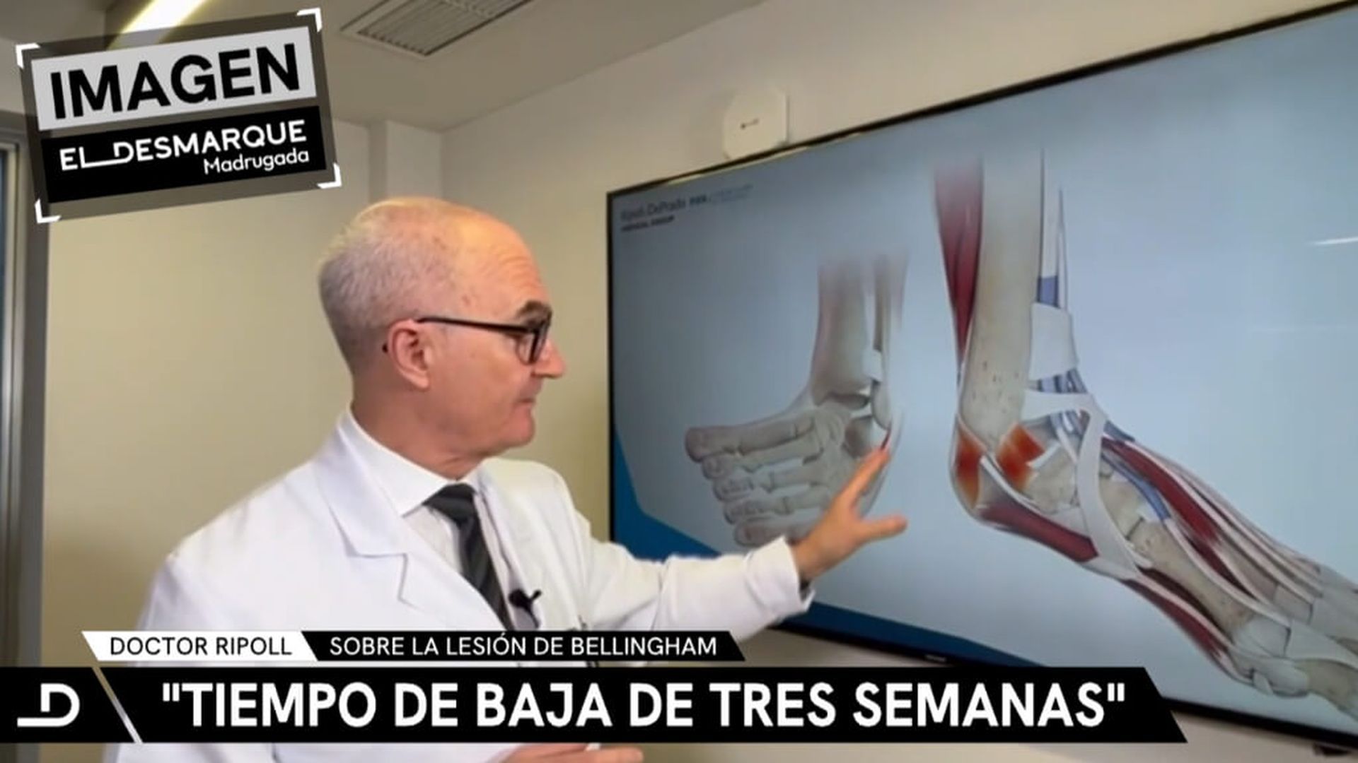 el_dr_ripoll_detalla_el_tiempo_de_recuperacion_de_bellingham_001.jpg