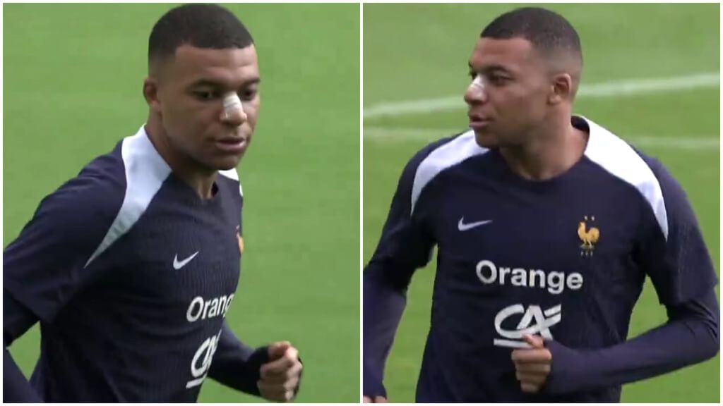 Kylian Mbappé se entrena sin máscara con Francia: una pequeña férula para proteger la nariz