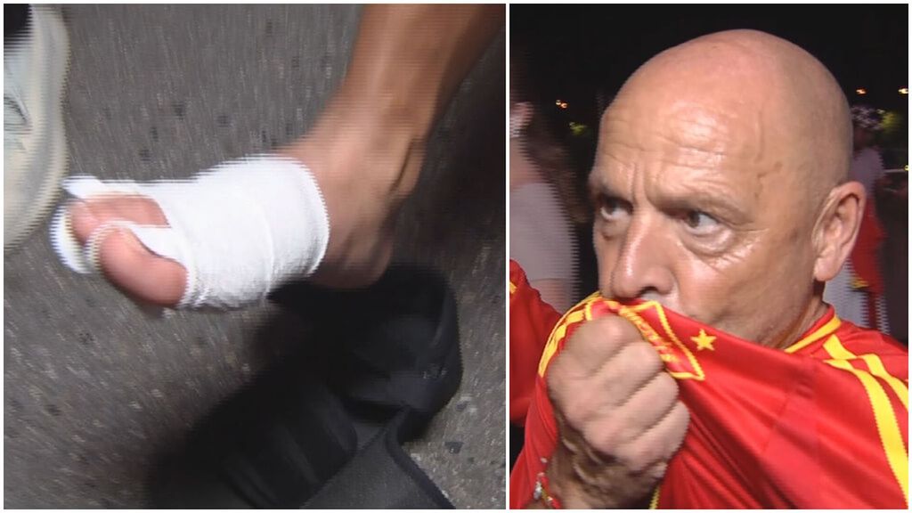 Operado hace ocho días, con 60 puntos en el pie y siguiendo a España por Alemania: la pasión de un aficionado