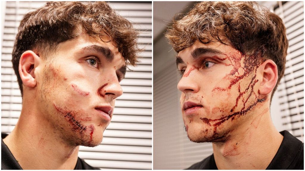 Pau Cubarsí y una patada en la cara que da miedo verla