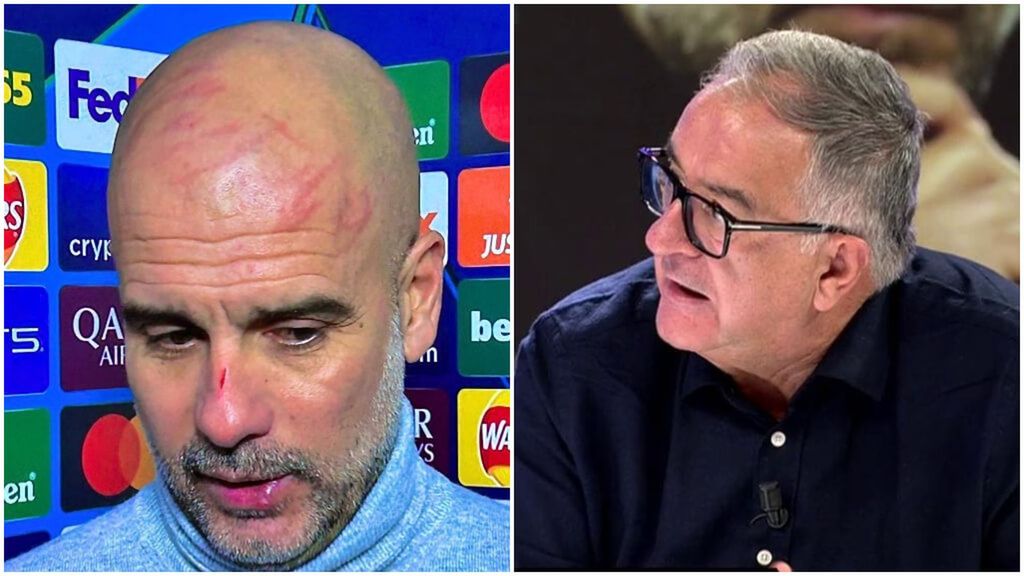 Preocupación con la situación de Pep Guardiola y sus cortes en la cara: "Es grave"
