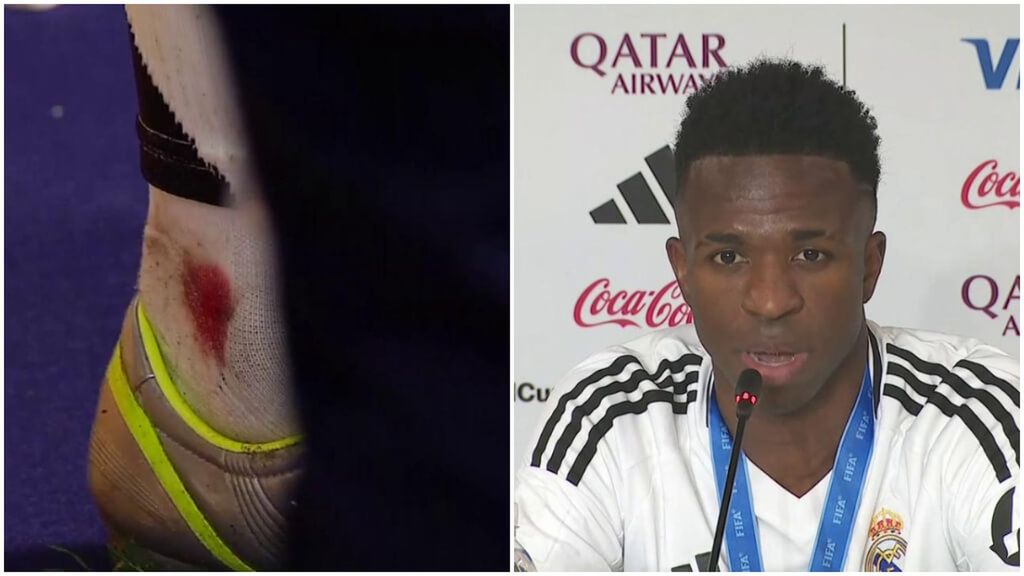 El partido de Vinicius en la Copa Intercontinental: de la herida en su tobillo a obtener el MVP