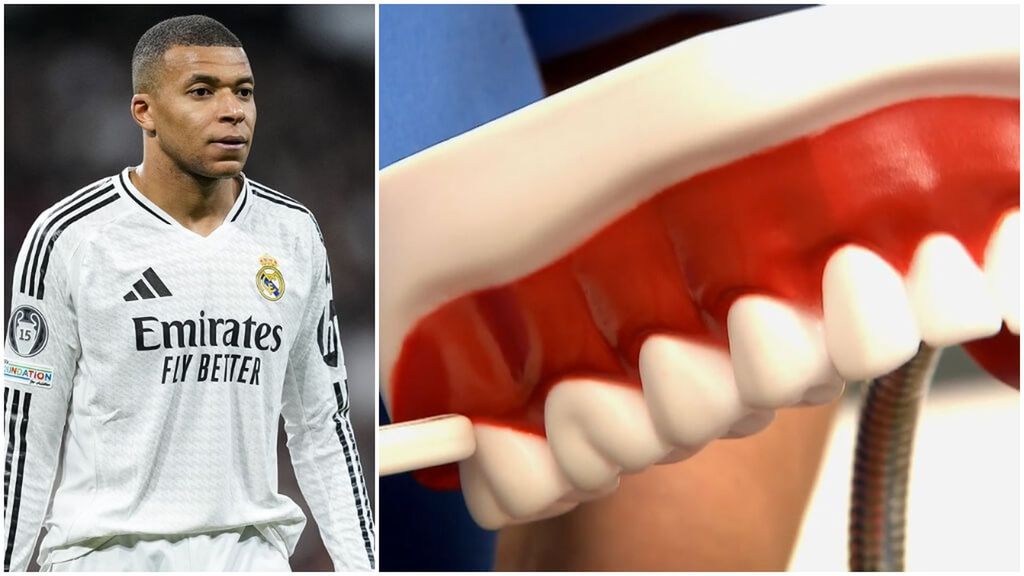 A vueltas con la muela de Mbappé, las consecuencias de la intervención y el runrún del madridismo