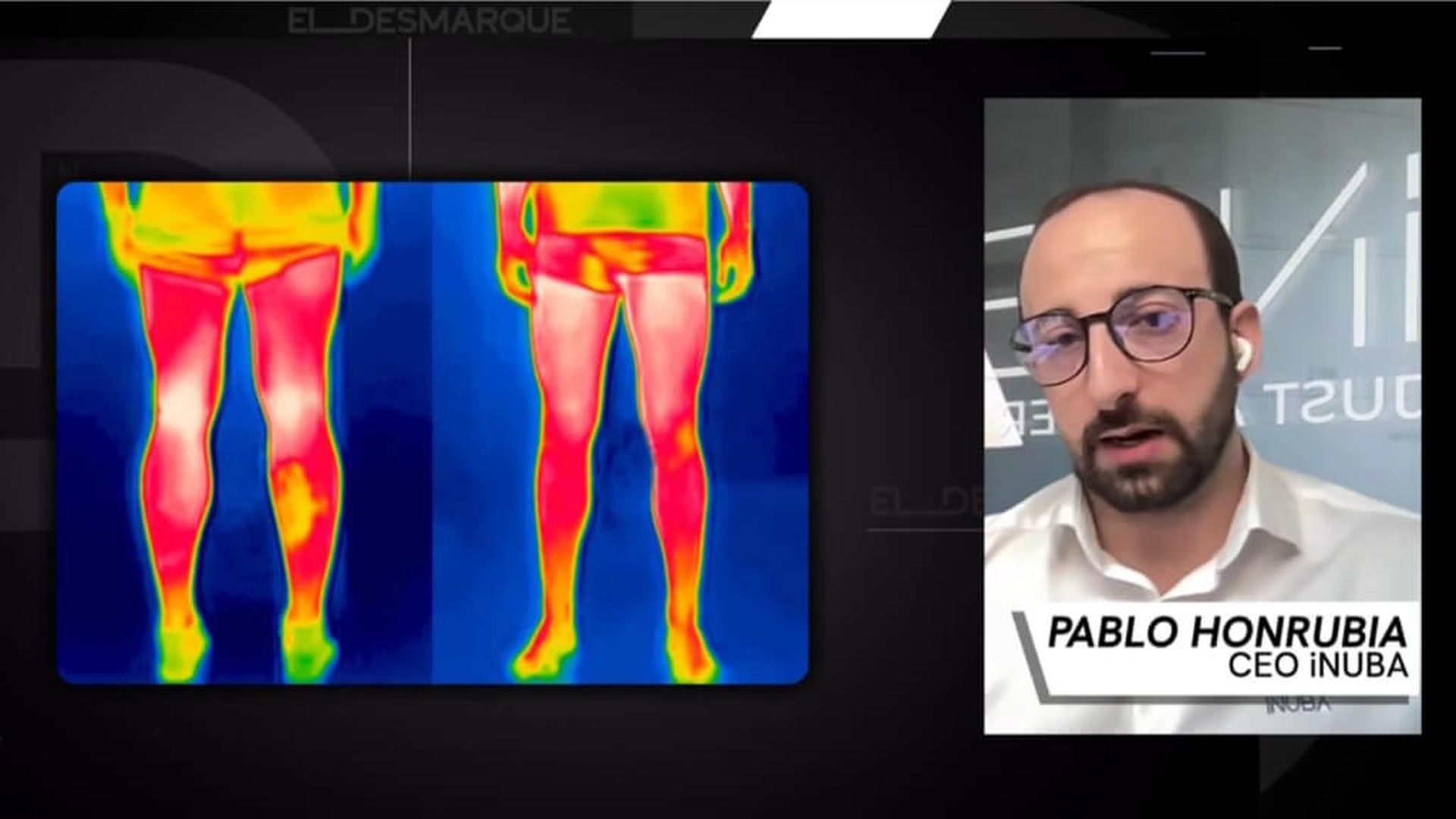 ia_lesiones_2jpg.jpg ia_lesiones_2jpg.jpg