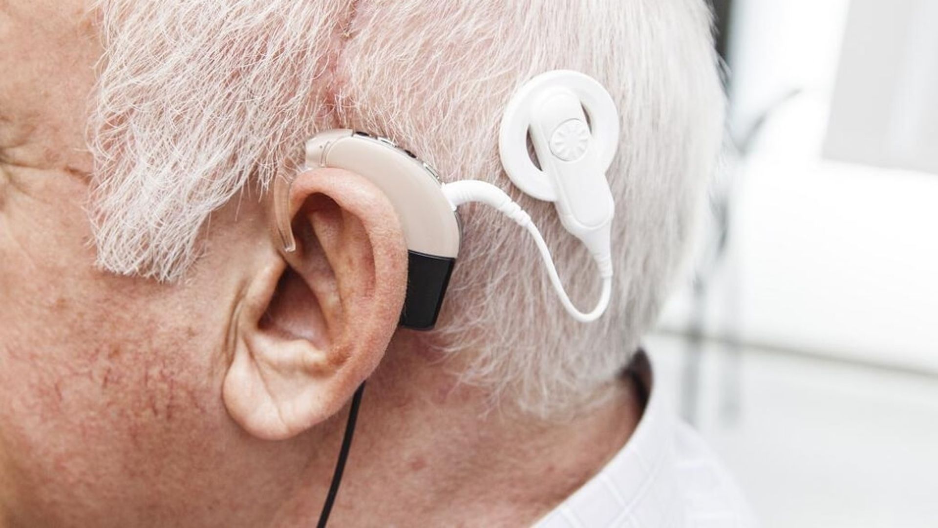 implante_coclearjpg_001.jpg implante_coclearjpg_001.jpg