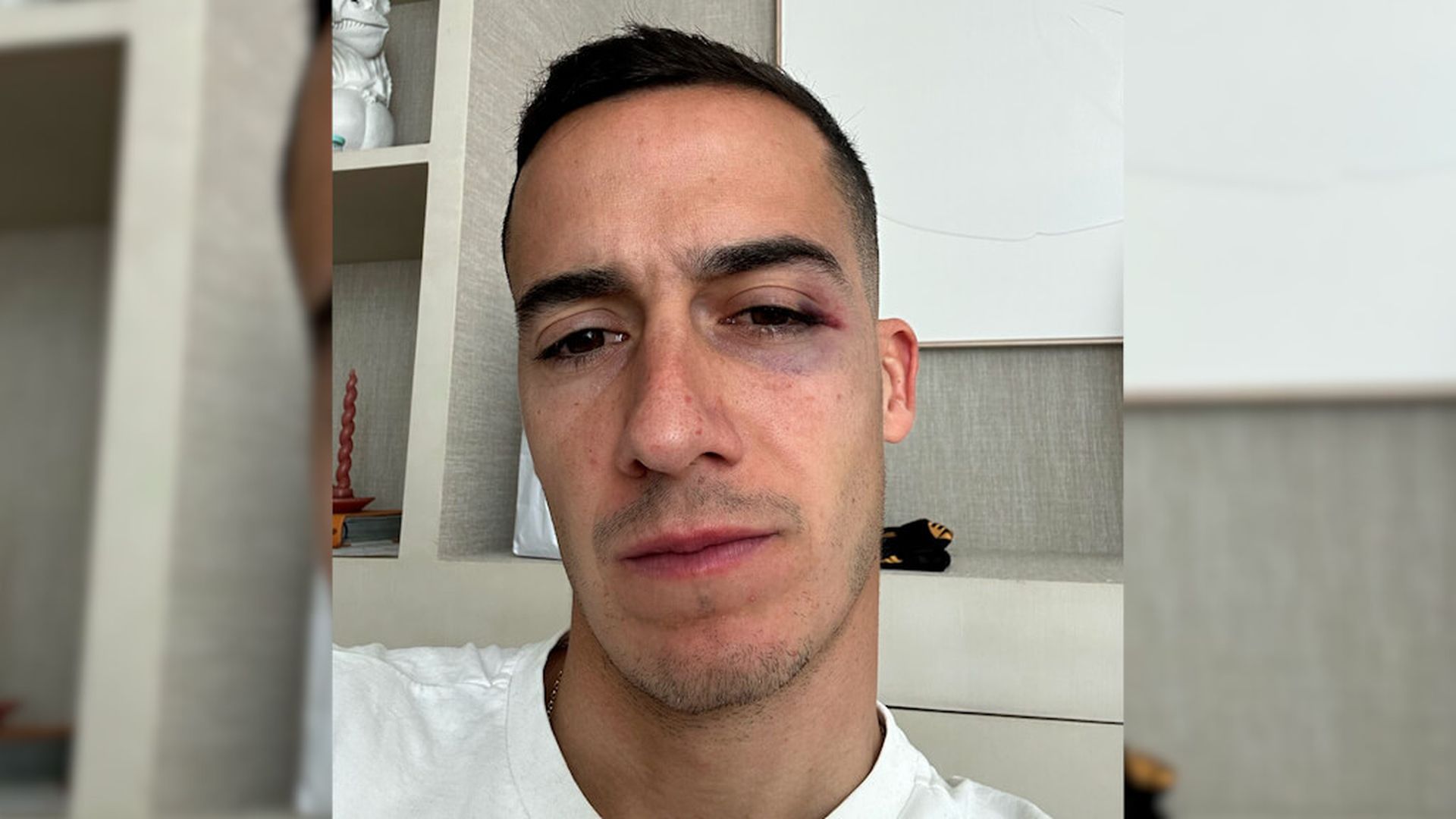 lucas_vazquez_muestra_como_ha_quedado_su_rostro_despues_del_codazo_de_en_nesyri.jpg lucas_vazquez_muestra_como_ha_quedado_su_rostro_despues_del_codazo_de_en_nesyri.jpg