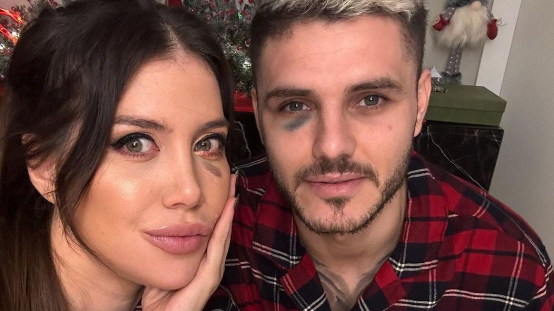 mauro_icardi_con_el_ojo_morada_tras_el_partido__mauroicardi_001.jpg mauro_icardi_con_el_ojo_morada_tras_el_partido__mauroicardi_001.jpg