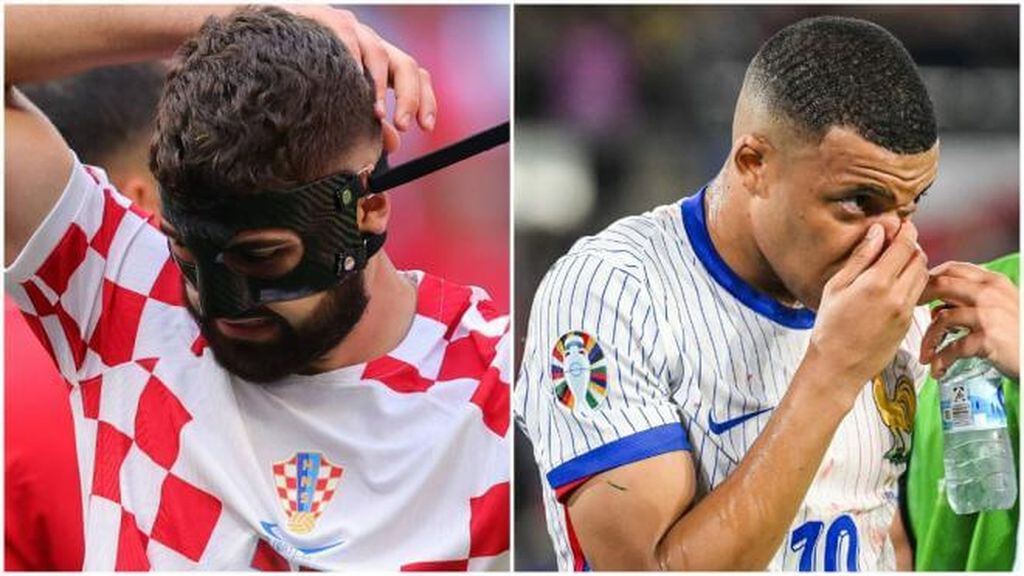 Los detalles de la máscara que llevará Mbappé: protección total para la nariz