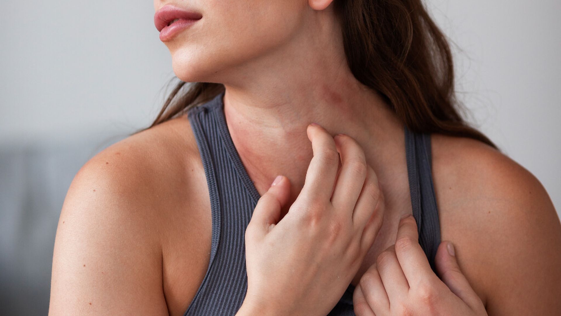 reaccion_cuellojpg.jpg reaccion_cuellojpg.jpg