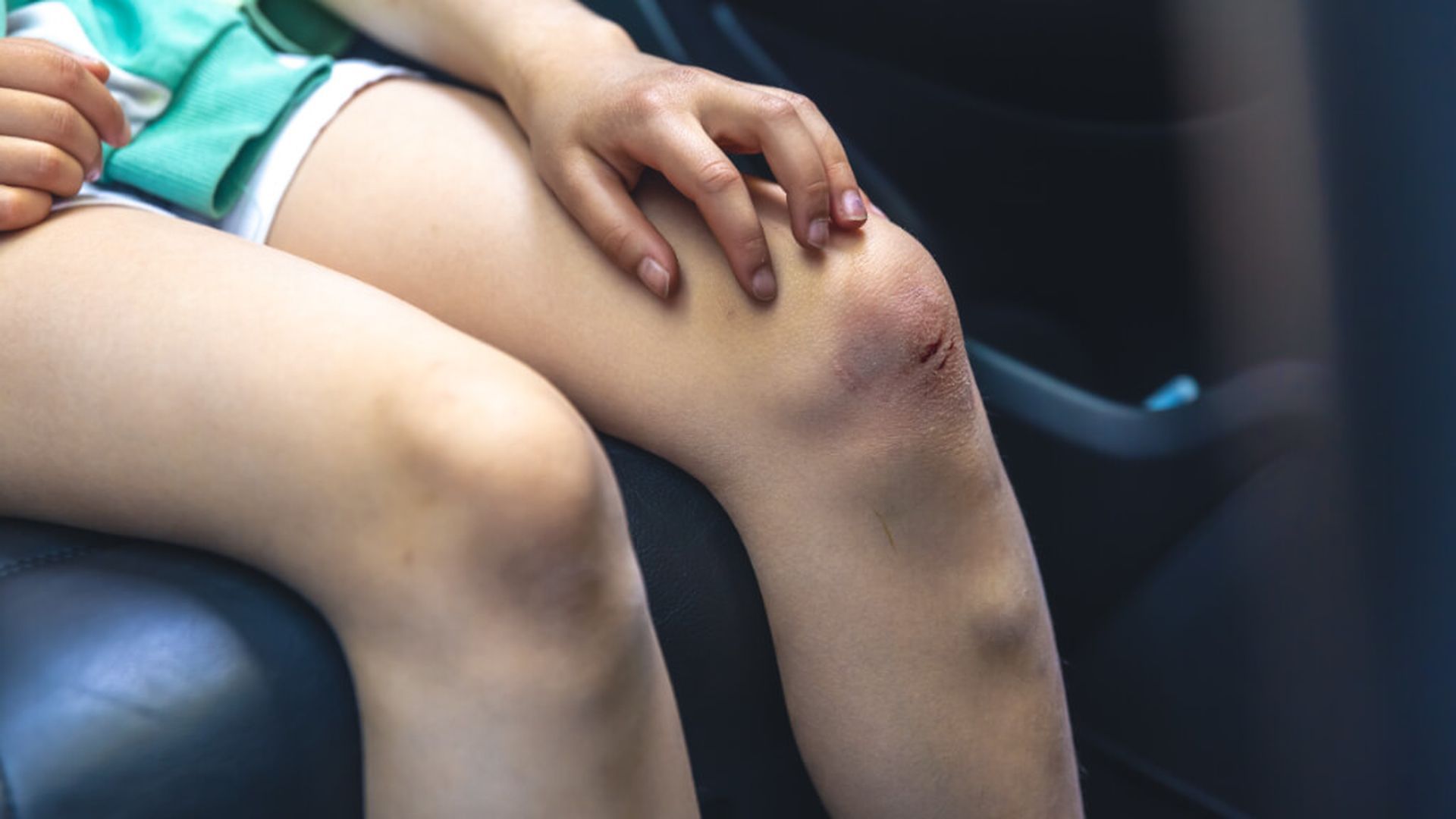 rodilla_magulladajpg_001.jpg rodilla_magulladajpg_001.jpg