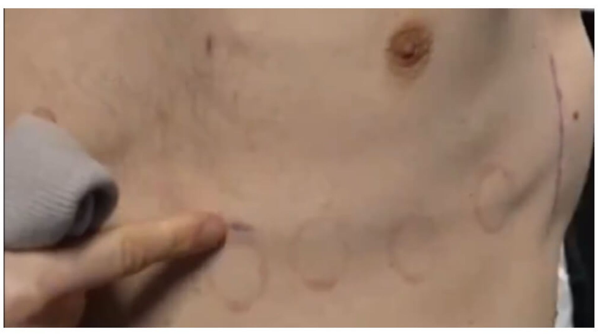 tom_lockyer_muestra_el_desfibrilador_2.jpg tom_lockyer_muestra_el_desfibrilador_2.jpg