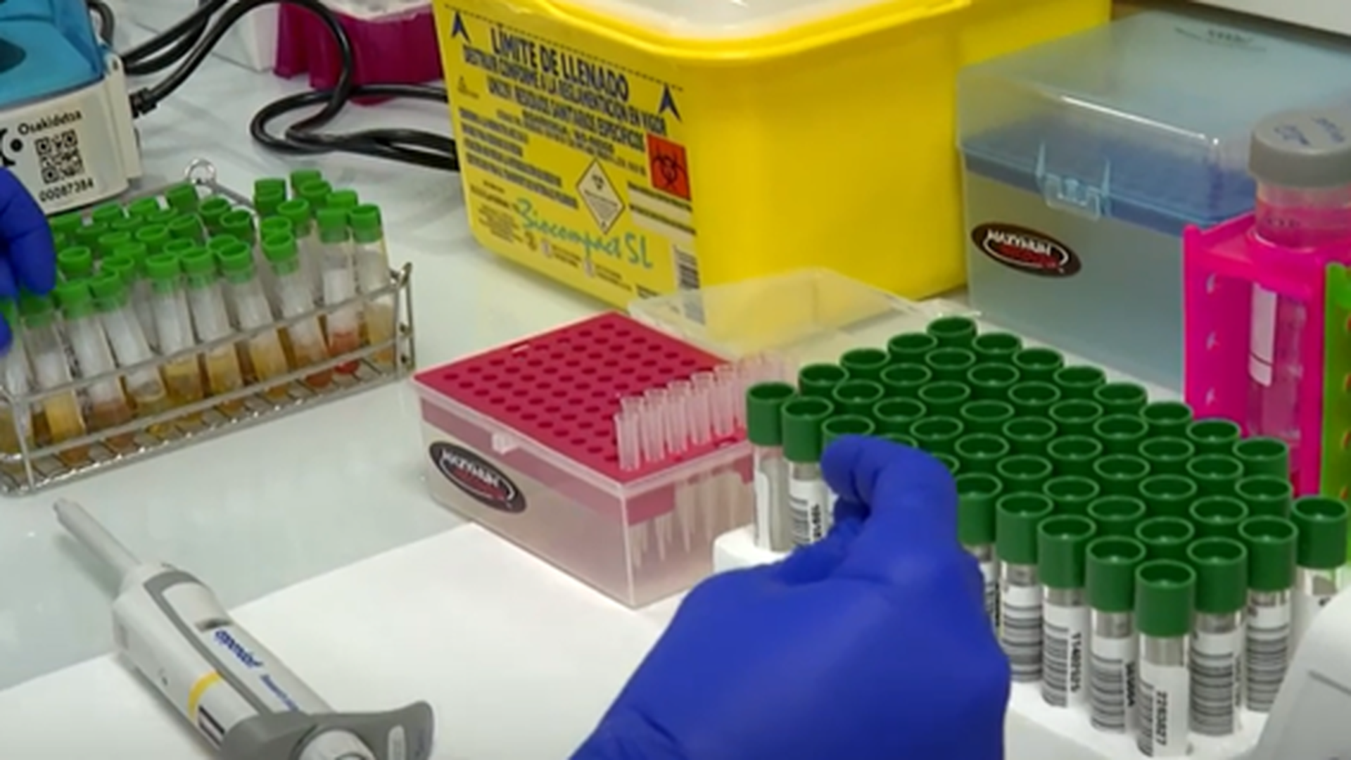 Se pide plan para cribados de diabetes en el congreso