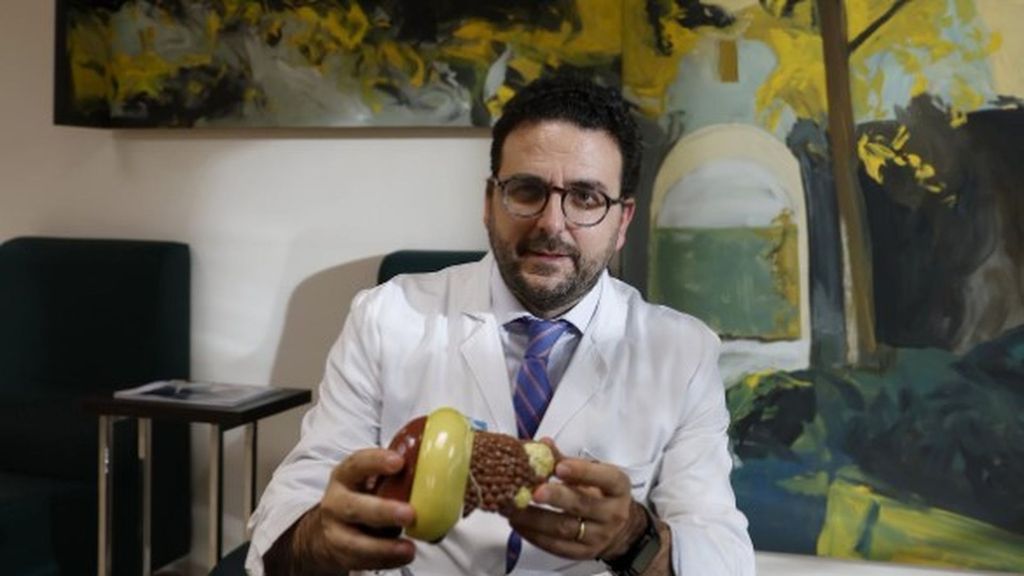 El especialista en enfermedades del hígado, Josep María Argemí.