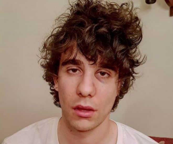 Javier Calvo, con la cara inflamada, después de la agresión