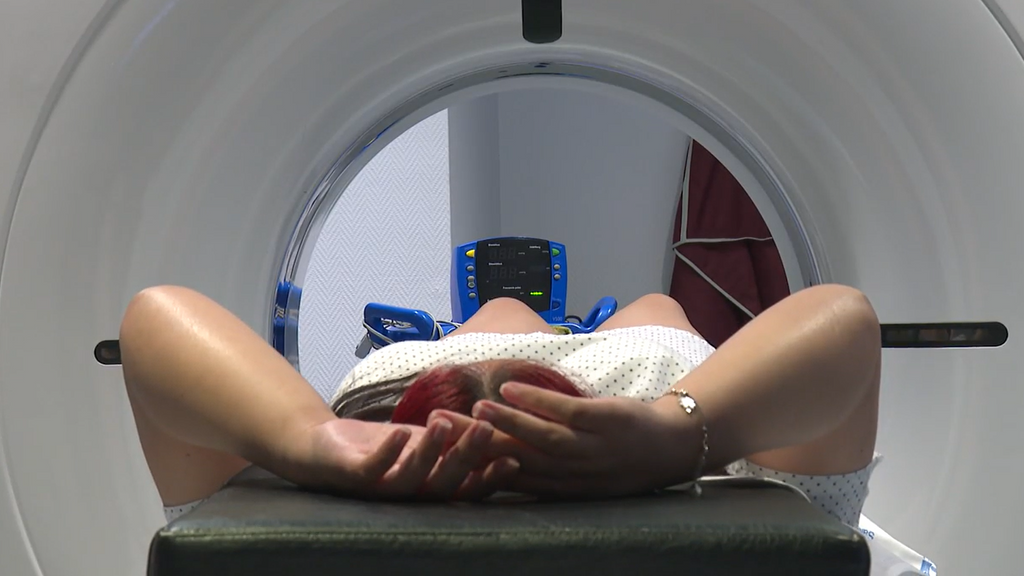 La prevención, fundamental contra el cáncer de pulmón: solo tres de cada diez pacientes superan los cinco años de supervivencia