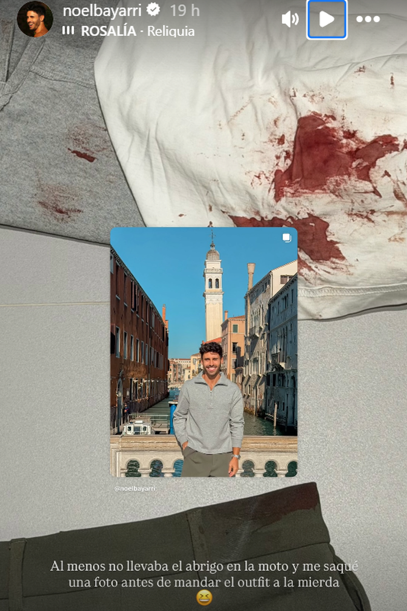 La ropa de Noel tras el accidente