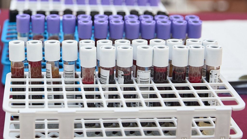 Viales con sangre extraída en una jornada de donación