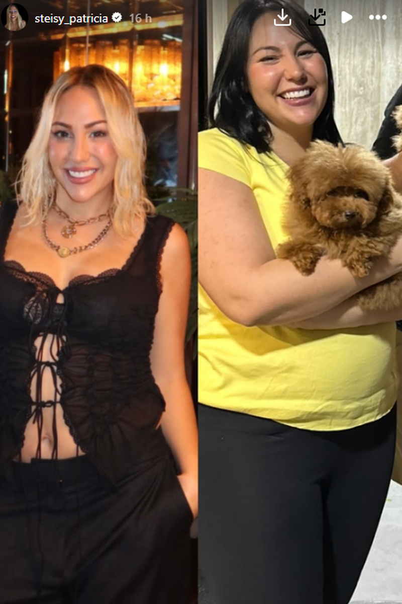 El impresionante antes y después de Patricia Steisy tras adelgazar 50 kilos en 5 meses