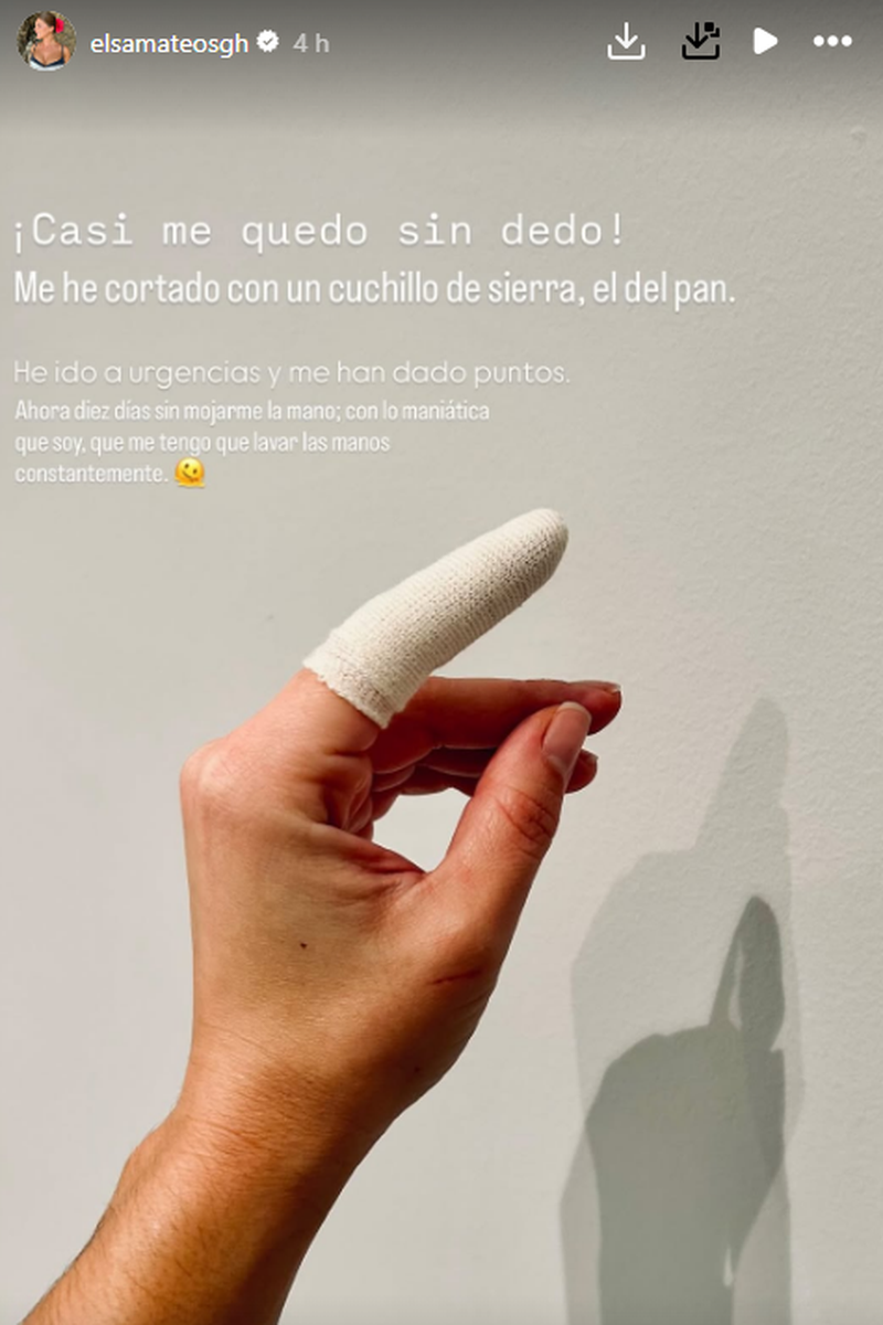 Elsa Mateos, de 'Gran Hermano', ha mostrado la lesión por la que ha acabado en el hospital